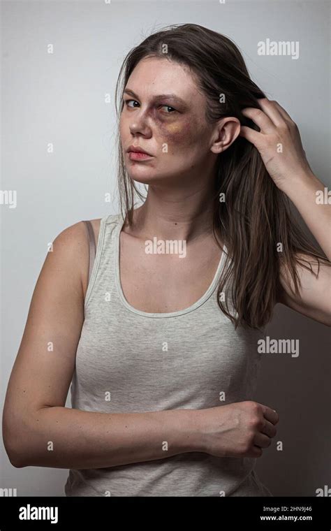 Facial Abuse .